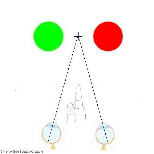 cva_3 cva_3
